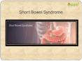 Short Bowel Syndrome: Causes, Symptoms, Daignosis, Prevention and Treatment PowerPoint PPT Presentation