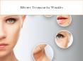 Effective Treatment for Wrinkles PowerPoint PPT Presentation