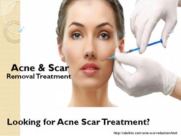 Acne & Scar Removal Treatment in Gurgaon