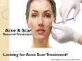 Acne & Scar Removal Treatment in Gurgaon (1) PowerPoint PPT Presentation