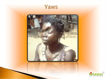 Yaws: Causes, Symptoms, Daignosis, Prevention and Treatment