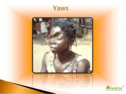 Yaws: Causes, Symptoms, Daignosis, Prevention and Treatment