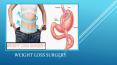 Weight Loss Surgery - Treatment of Obesity PowerPoint PPT Presentation