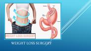 Weight Loss Surgery - Treatment of Obesity