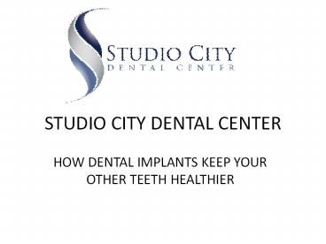 HOW DENTAL IMPLANTS KEEP YOUR OTHER TEETH HEALTHIER