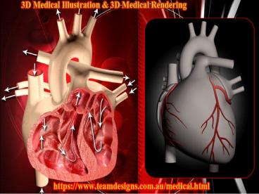 3D Medical illustration | 3D Medical rendering | Medical model rendering