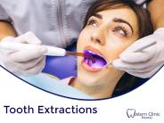 Western Clinic Dental - Tooth Extraction PowerPoint PPT Presentation