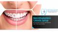 Invisalign Colorado Springs | Medicaid Braces Colorado Springs PowerPoint PPT Presentation