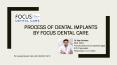 Process of Dental Implants | Dental Implants in India PowerPoint PPT Presentation