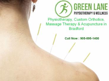 Acupuncture Bradford