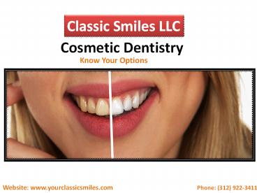 Chicago Beautiful Smiles - Best Cosmetic Dentist in South loop Chicago,IL