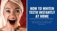 How to Whiten Teeth Instantly at Home PowerPoint PPT Presentation