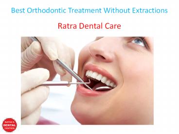 Best Orthodontic Treatment Without Extractions
