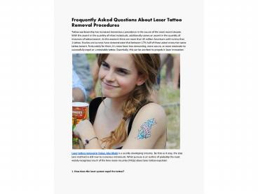 Frequently Asked Questions About Laser Tattoo Removal Procedures