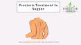 Best Ayurvedic psoriasis doctor in nagpur