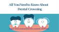 All You Need to Know About Dental Crowning PowerPoint PPT Presentation