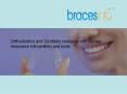 Cost of Braces Treatment PowerPoint PPT Presentation