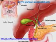 Safra Kesesi Hastalıklari