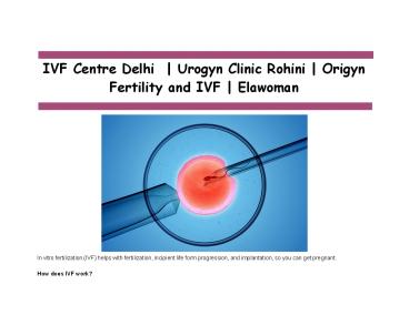 IVF Centre Delhi  | Urogyn Clinic Rohini | Origyn Fertility and IVF | Elawoman