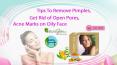 Tips to Remove Pimples, Get Rid of Open Pores, Acne Marks on Oily Face PowerPoint PPT Presentation