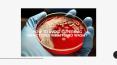 Smart and a Fail-Proof Protection from Superbug Infection PowerPoint PPT Presentation