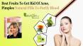 Best Fruits Which Purify Blood and Get Rid of Acne and Pimples Easily PowerPoint PPT Presentation