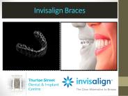 Invisalign Braces
