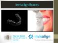 Invisalign Braces (1) PowerPoint PPT Presentation
