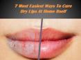 7 Most Easiest Ways To Cure Dry Lips At Home Itself PowerPoint PPT Presentation