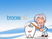 Braces for Teeth
