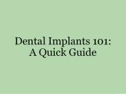 Dental Implants 101: A Quick Guide