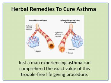 Herbal Cures For Asthma Doctor Advice