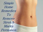 Simple Home Remedies To Remove Stretch Marks Permanently