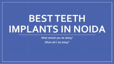 Best Teeth Implants in Noida