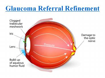 Glaucoma Referral Refinement