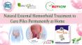 Natural External Hemorrhoid Treatment to Cure Piles Permanently at Home PowerPoint PPT Presentation