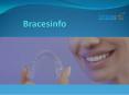 Invisalign Braces Reviews PowerPoint PPT Presentation