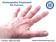 Effective Homeopathy Treatment For Psoriasis PowerPoint PPT Presentation