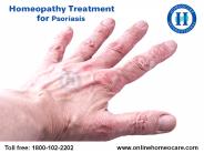 Effective Homeopathy Treatment For Psoriasis