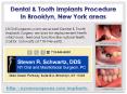 Dental & Tooth Implants Procedure in Brooklyn, New York areas - NYOMSurgeons.com PowerPoint PPT Presentation