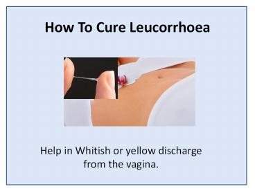 Leucorrhoea Treatment