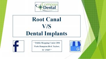Root Canal V/S Dental Implant