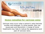 Home remedies for varicose veins