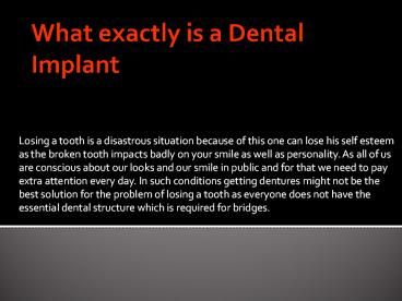 What exactly is a Dental Implant
