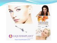 Dermal Fillers