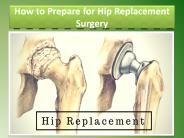 How to Prepare for Hip Replacement Surgery