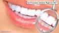 Are Porcelain Veneers Right for Me? - Lookswoow PowerPoint PPT Presentation