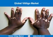 Global Vitiligo Market Growth