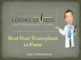 Best Hair Transplant in Pune PowerPoint PPT Presentation