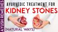 Best Way to Pass a Kidney Stone without Surgery Naturally at Home PowerPoint PPT Presentation